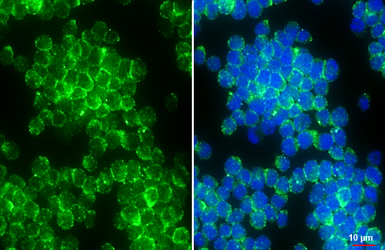 Anti-ICAM1 / CD54 antibody [HL4447] used in Immunocytochemistry/ Immunofluorescence (ICC/IF). GTX644012